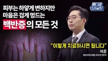 [메디컬 인사이트 63회] 피부과 전문의가 알려주는 '백반증'의 증상과 치료법 / YTN