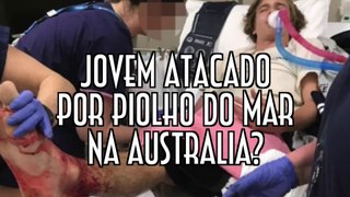 Jovem atacado por piolho do mar na Australia? - EMVB - Emerson Martins Video Blog 2017