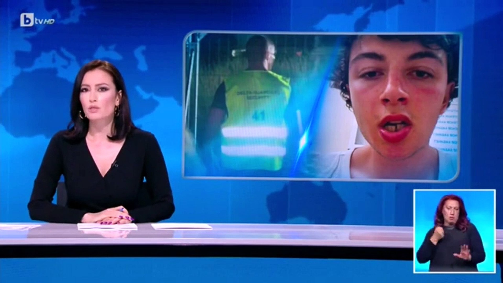⁣Bulgarian cop breaks the jaw of a college student FOR NO REASON!