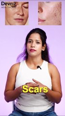 dark spots से छुटकारा पाएं: Pigmentation Treatment Kit  के साथ