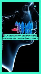 🧬 La disparition des dents de sagesse est-elle due à l'évolution ?