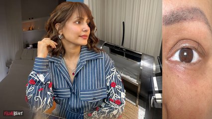 Hina Khan Cancer Treatment के बीच पहुंची विदेश, ले रहीं है स्पेशल थेरेपी, बोलीं 'ये मेरी हेल्थ...'