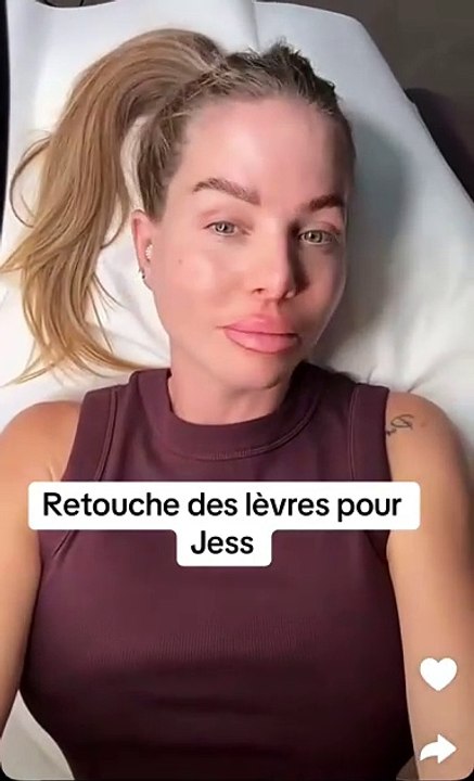 "Quelle horreur !" : le visage défiguré de Jessica Thivenin après une nouvelle chirurgie choque la Toile