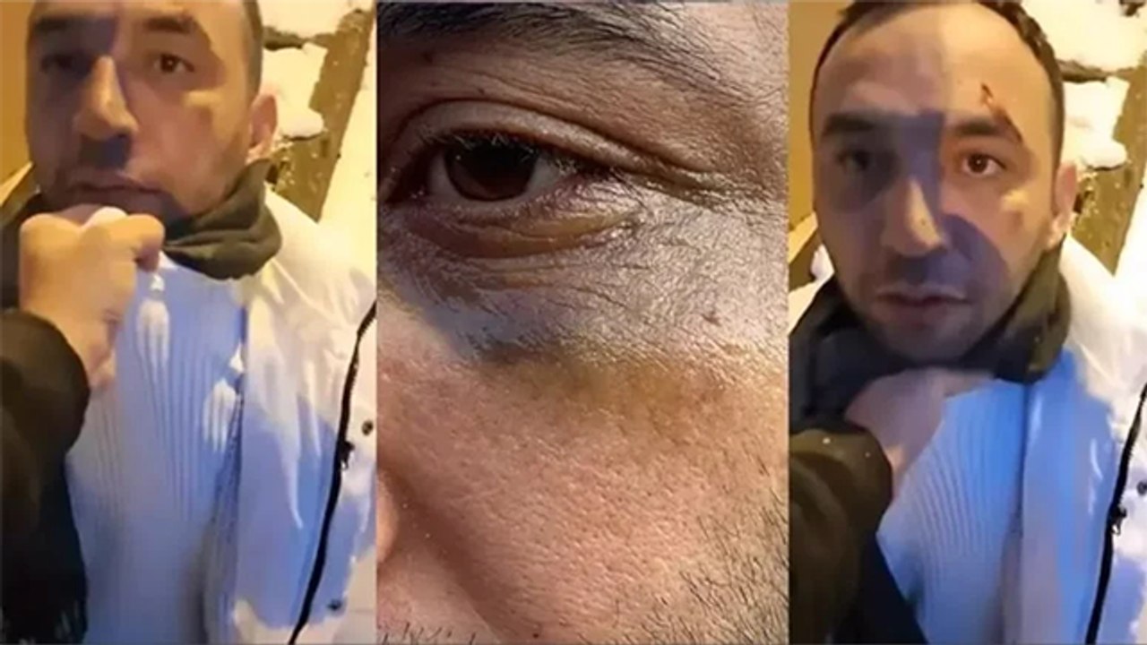 İstanbul'da eski sevgiliye yeni sevgili tuzağı... Yaşadığı dehşeti anlattı