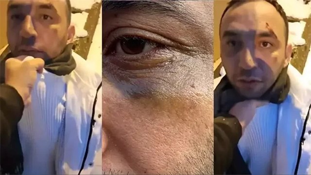 İstanbul'da eski sevgiliye yeni sevgili tuzağı... Yaşadığı dehşeti anlattı