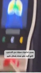 خالد الرفاعي يكشف تفاصيل معاناته الصحية بسبب التدخين