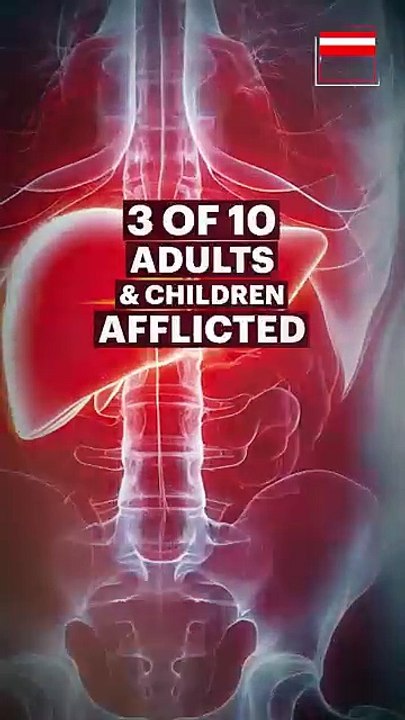 Deadly Non-alcoholic Fatty Liver Disease - Symptoms & Safeguards