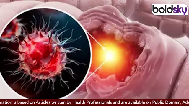 Intestine Swelling Symptoms In Hindi: Aant Me Sujan Ke Lakshan, Gas In Stomach & Sudden Weight loss