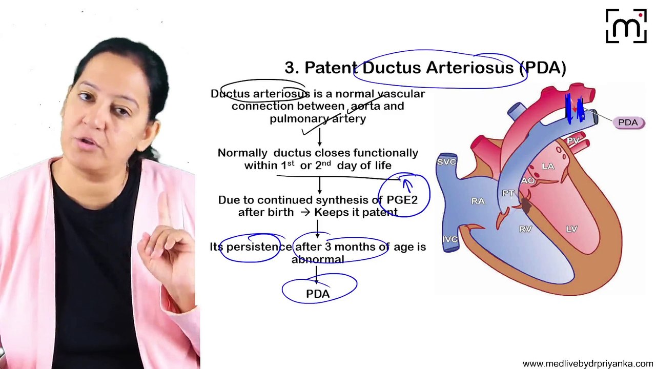 1.1 Congenital heart disease Part 2