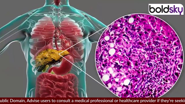 Sugarcane Juice Benefits: किस बीमारी में गन्ने का जूस पीना फायदेमंद,UTI Problem,Fatty Liver Remedy