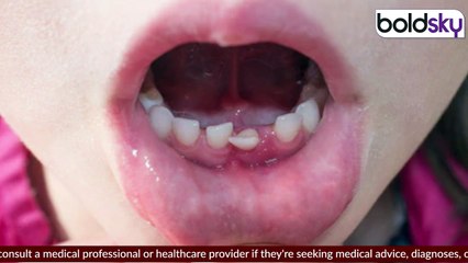 Milk Teeth Falling Age : दूध के दांत कि आयु तक गिर जाते है, कितने होते है | Boldsky