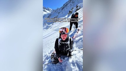 Skier breaks nose while attempting backflip