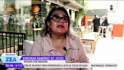 Vivir con obesidad: el testimonio de  Dinorah; llegó a pesar más de  147 kilos