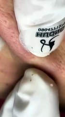ASMR Therapy | Sacdepspa Treatment for Relaxation