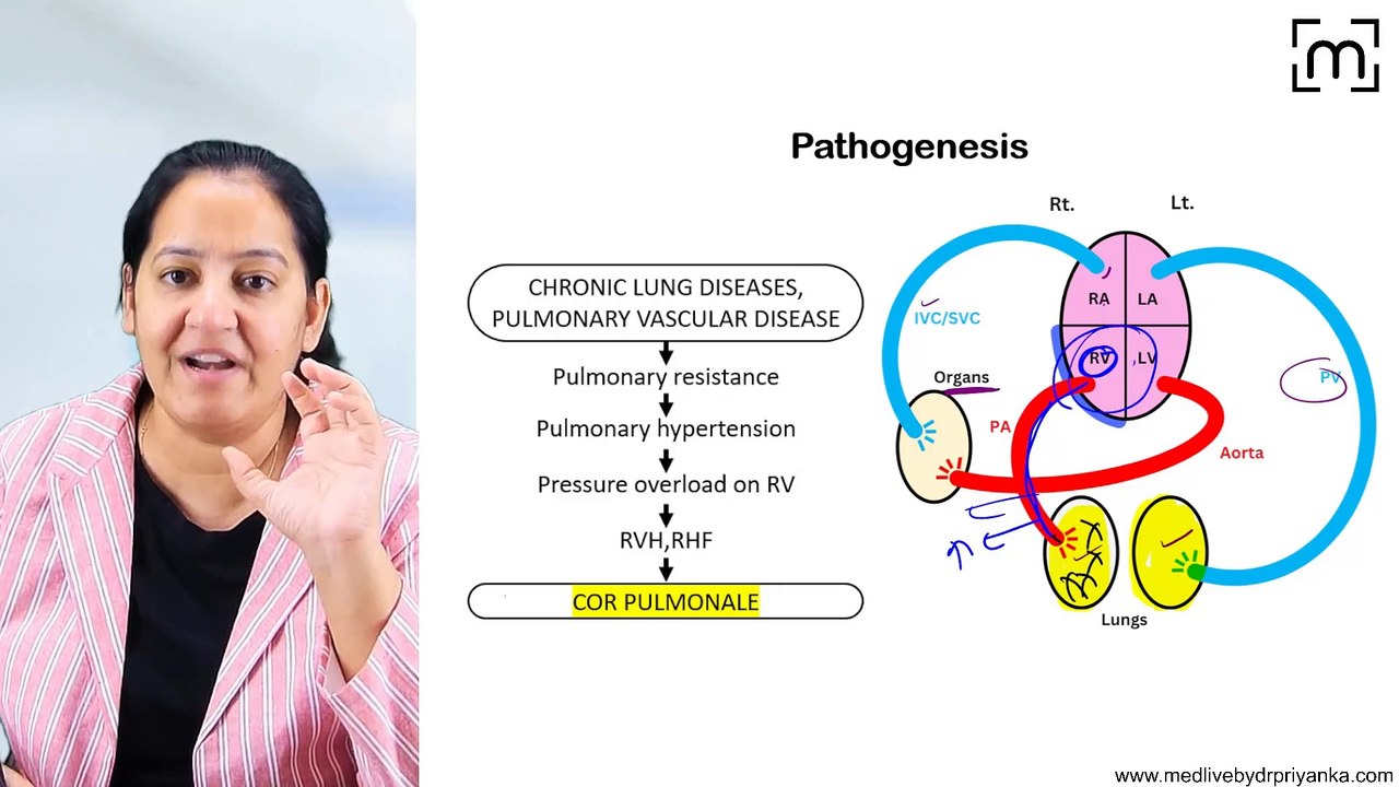 8. Cor Pulmonale
