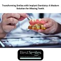 transforming smiles with implant dentistry