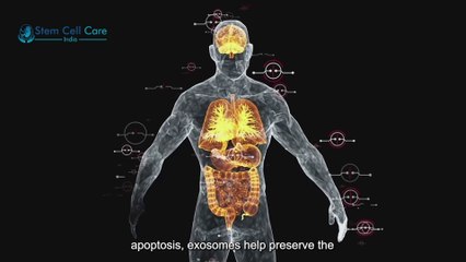 Revolutionary Pancreatitis Treatment with Exosomes | Mesenchymal Stem Cells (MSCs) |