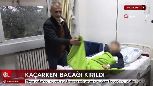 Diyarbakır'da köpek saldırısına uğrayan çocuğun bacağına platin takıldı