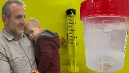 1 buçuk aydır öksürük nöbeti geçiriyordu, sebebi doktorları bile şaşırttı