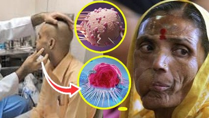 Difference Between Tumor And Cancer: कैंसर और ट्यूमर में क्या अंतर होता है | Boldsky