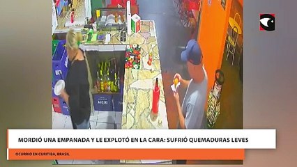 Mordió una empanada y le explotó en la cara sufrió quemaduras leves