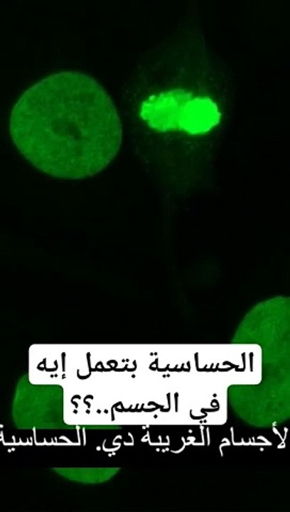 الحساسية بتعمل إيه في الجسم.. _shorts _short _shortsfeed _shortvideo _viral _viralvideo _facts(360P)(480P)