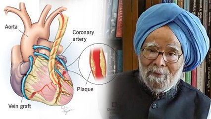 Former PM Dr. Manmohan Singh 92 Age Disease Reveal, Bypass Surgery To Diabetes...