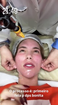 Virginia enfrenta combo de procedimentos estéticos para entrar 2025 renovada