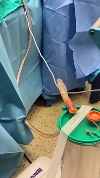 Liposuction Surgery in Dubai UAE Lipo Clinic