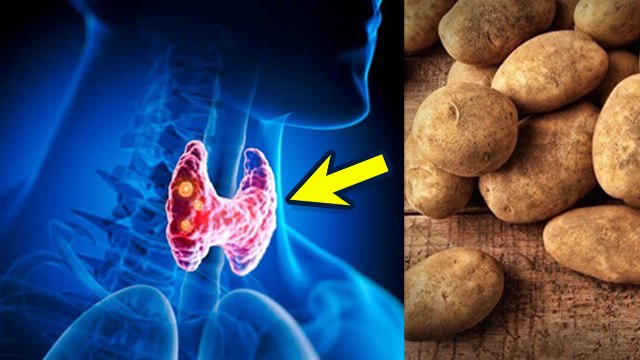थाइरोइड में आलू खा सकते है |Thyroid Me Aloo Khana Chahiye Ya Nahi |Potato Benefits...