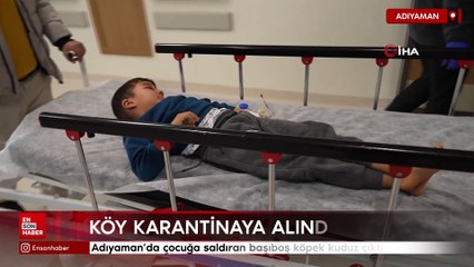 Adıyaman'da çocuğa saldıran başıboş köpek kuduz çıktı