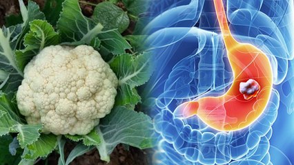Cauliflower Side Effects:Gobhi Khane Ke Nuksan|किन लोगों को गोभी नहीं खानी चाहिए, Thyroid To Acidity