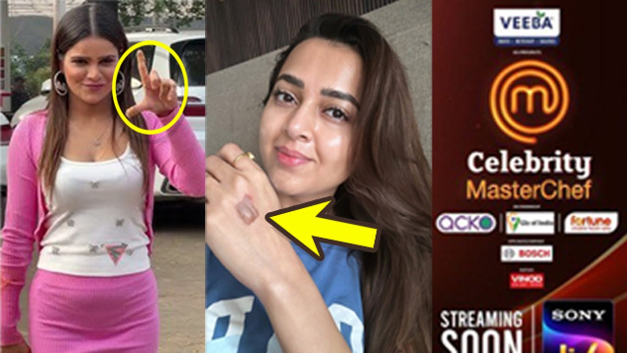 Tejasswi Prakash & Archana Gets Injured On Celebrity MasterChef Shares Shocking Post,Public Reaction