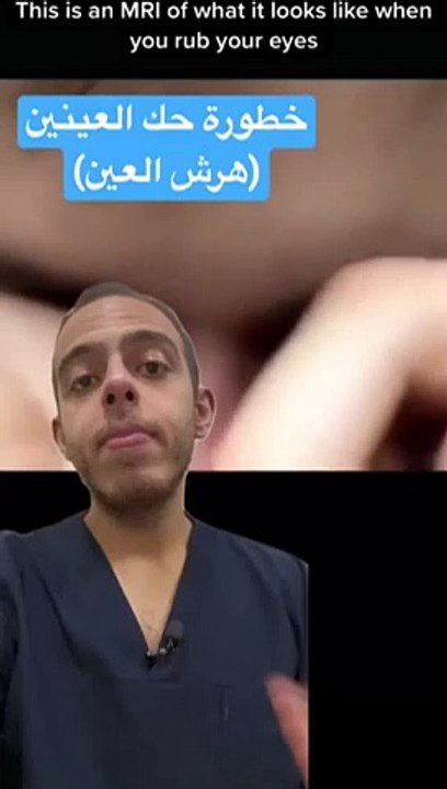 خطورة حك العينين _medicine _طب _shorts(360P)(480P)1