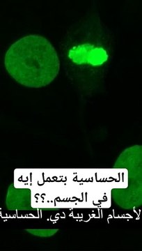 الحساسية بتعمل إيه في الجسم.. _shorts _short _shortsfeed _shortvideo _viral _viralvideo _facts(360P)(480P)