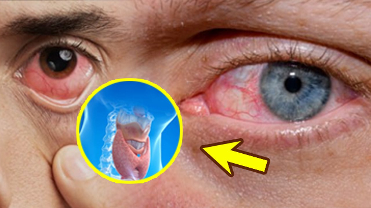 Diseases Signs in Eyes: आंखों से बीमारियों का पता लगाने का तरीका, Blood Sugar, Thyroid To Cancer