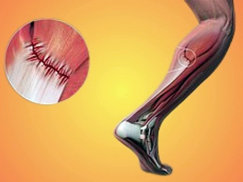 Sprain first aid treatment in hindi | What is the first aid for sprain,