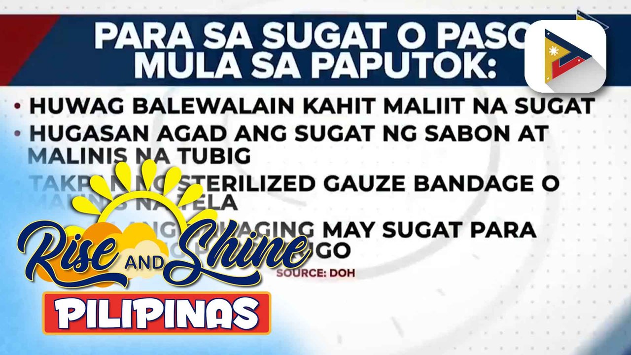 DOH, may paalala sa publiko hinggil sa first aid para sa fireworks-related injuries