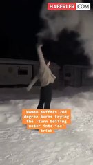 'Kaynar Su-Buz' akımı için video çekerken feci şekilde yandı