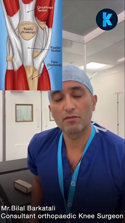 Mr. Bilal Barkatali Explains Quadriceps Tendon Ruptures
