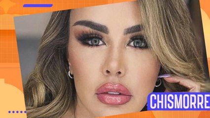 Mucha controversiaNinel Conde en el ojo del huracán por los cambios en su rostro