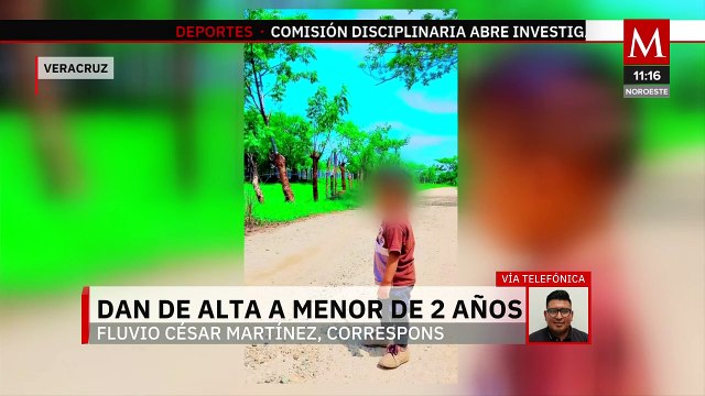 Dan de alta a menor de 2 años que sufrió quemaduras con agua hirviendo en Veracruz