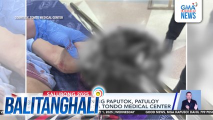 Mga nasabugan ng paputok, patuloy na dumarating sa Tondo Medical Center | Balitanghali