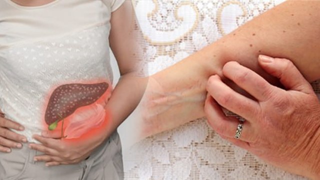 Liver Infection Causes: लिवर इन्फेक्शन क्यों होता है, Symptoms And Reason | Boldsky