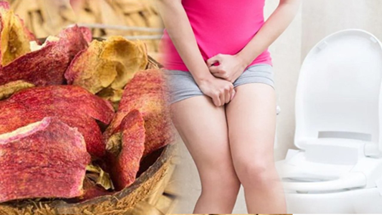 Bar Bar Peshab Aane Ka Ilaj | बार बार पेशाब आने का इलाज | Boldsky