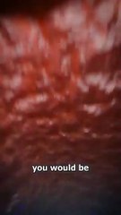What Happens if Swallowed by sperm whale