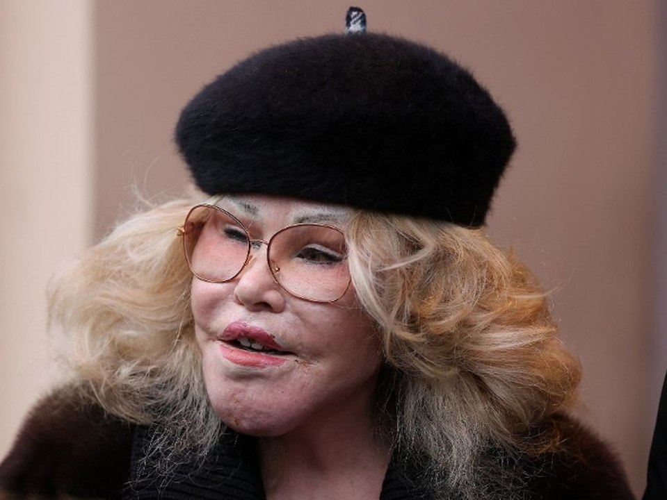 "Katzenfrau" Jocelyn Wildenstein ist tot