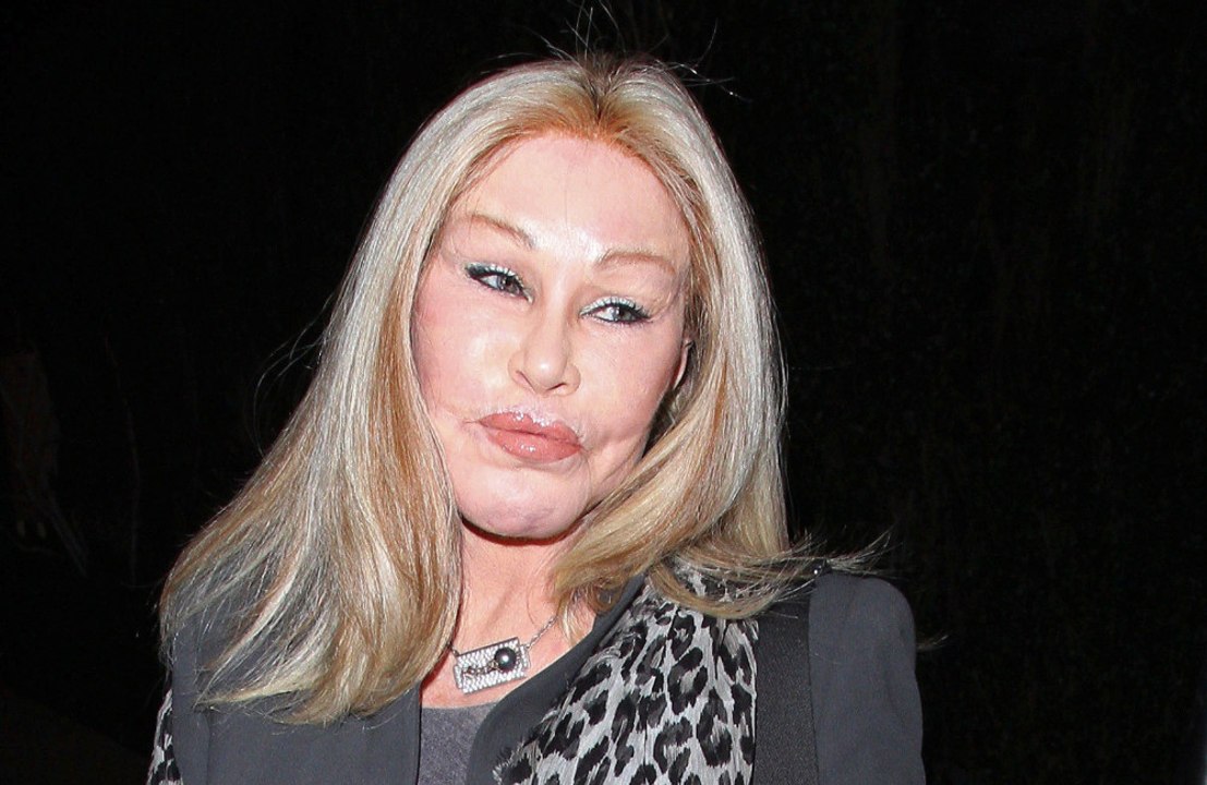 Jocelyn Wildenstein: Im Alter von 84 Jahren verstorben