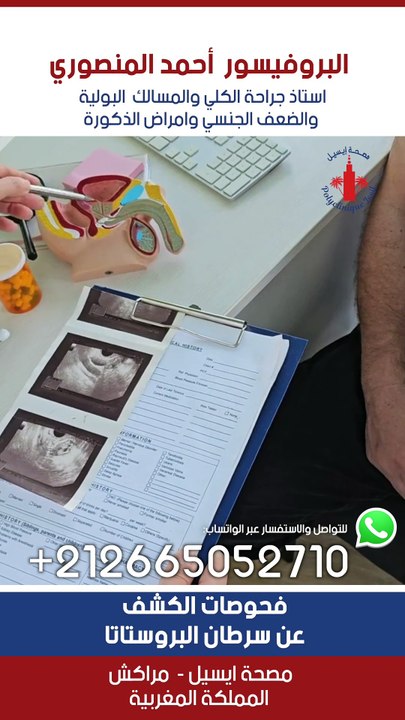 فحوصات الكشف عن سرطان البروستاتا #الانتصاب #ذكور #سرطان_البروستاتا #medicine #morocco #علاج #doctor #urologue #سرعة_القذف #casablanca #urology #النحافة #البروستاتا #instahealth #الضعف_الجنسي