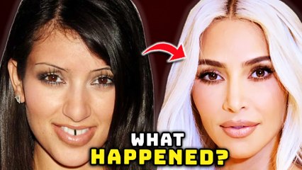 Kim Kardashian's Face - Before and After